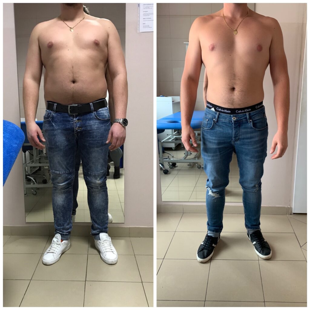 Utrata wagi i poprawa sylwetki dzięki Activmed